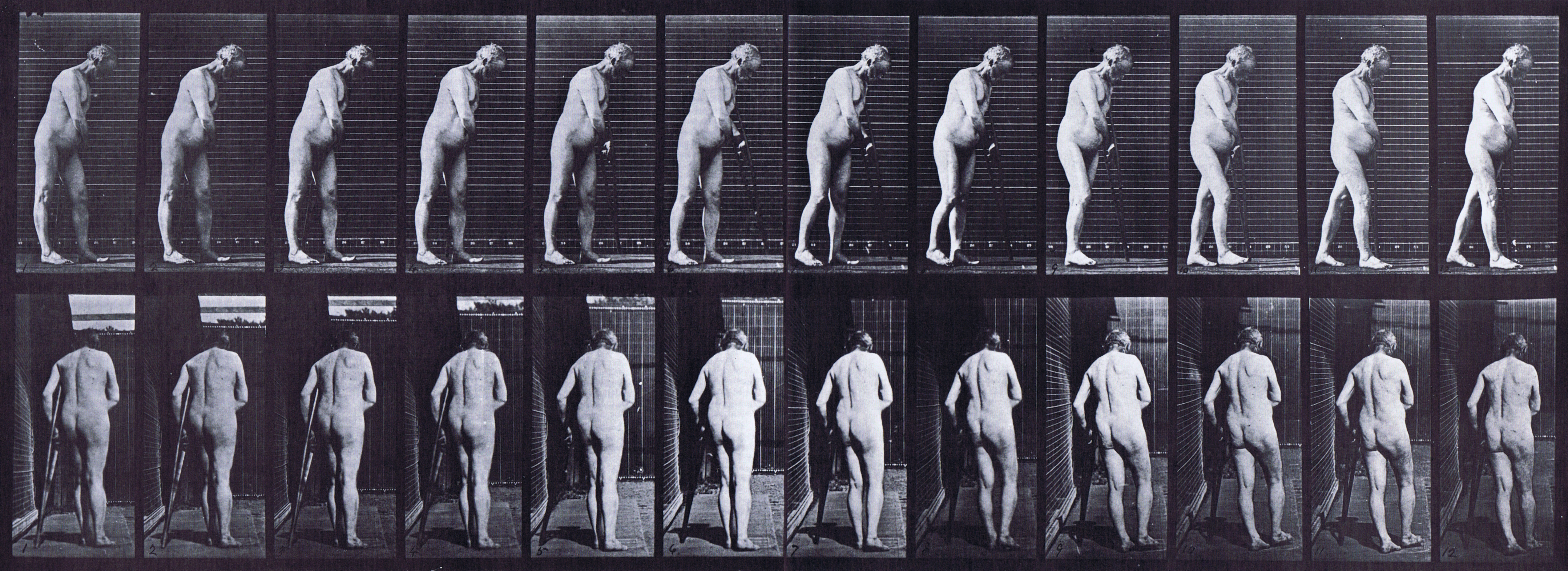 large profile and rear views of nude male spastic walking with a crutch animation reference using muybridge plate 547 from animal locomotion